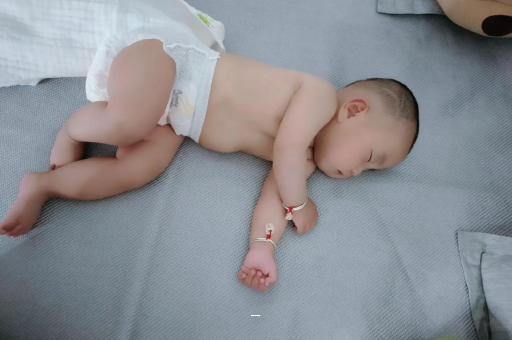 朔州宝宝脸上有白色斑块